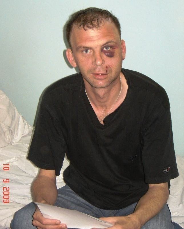Михаил Афанасьев в больнице после очередного избиения, 2009 год. Фото: из его личного архива