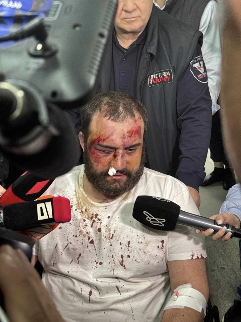 Последствия избиения Димитрия Чиковани. Фото: Jam-news
