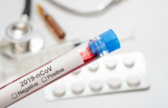 В ближайшие дни в Литву доставят реагенты для тестов на коронавирус