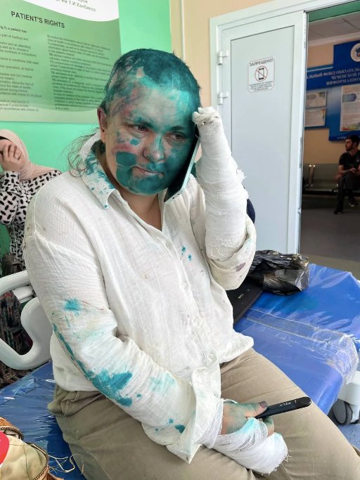 Елена Милашина после нападения. Фото: «Команда против пыток»